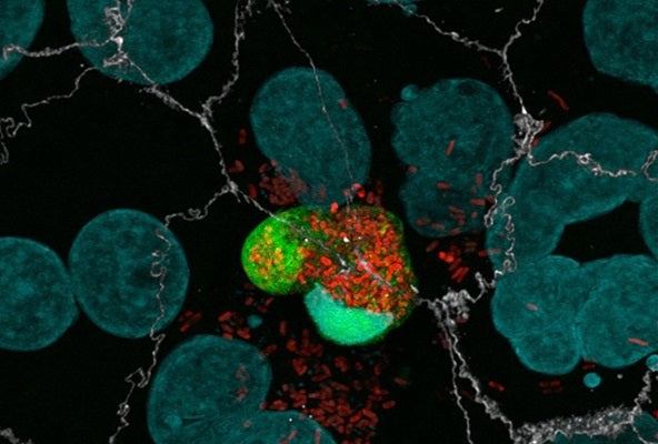 Figure 2. C2BBe1 cells were infected with wild type Salmonella constitutively expressing mCherry (red). After 9 hours, live cells were incubated with FAM-YVAD-FMK (green cell) for 1 hour. The infected cell (red) is undergoing pyroptosis, and shows increased green fluorescence compared to uninfected cells due to caspase-1 activation. Data courtesy Knodler, Leigh A., et al. Dissemination of invasive Salmonella via bacterial-induced extrusion of mucosal epithelia. PNAS. 107:41, 17733-17738 (2010).