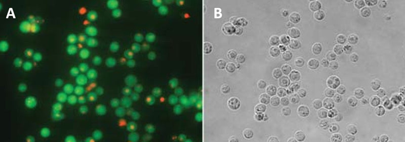 Figure 3. Jurkat suspension cells were exposed to staurosporine, and then stained with FAM-FLICA® and 7-AAD. Cells in early stage apoptosis fluoresce green with FAM-FLICA®, cells in mid-to-late stage apoptosis fluoresce green with FAM-FLICA® and red with 7-AAD, and necrotic cells fluoresce red with 7-AAD. Panel B the corresponding DIC image. FAM-FLICA® and 7-AAD were imaged using a 470-490 nm excitation filter plus >520 nm long pass filter tandem. Data courtesy of Dr. Brian W. Lee (ICT 196:70).