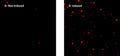 Figure 1. Suspension Jurtkat cells were treated with DMSO (control, A) or 1 µM staurosporine (B) for 4 hours at 37°C, then stained with SR-LETD-FMK (kit cat. 9149/9150) for 1 hour at 37°C. Cells were washed three times and slides prepared. Treated cells appear bright red, indicating a