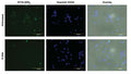 Figure 4. Jurkat cells were treated with the cathepsin inhibitor, E-64d (lower), or were untreated (upper). Cells were then stained with R110-(RR)2, followed by Hoechst 33342, and then mounted onto coverslips and imaged. Intracellular localization of the hydrolyzed (fluorescent) R110 product was detected using EGFP (Ex 470/30, Em 530/50) and DAPI (Ex 375/28, Em 460/50) LED filter cubes at 20X. The overlay includes a brightfield image. Data courtesy of Dr. Kristi Strandberg (ICT 231:65-68).