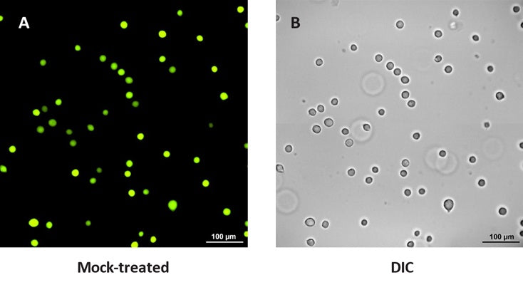 Figure 2. Mock-treated Jurkat suspension cells were stained with Calcein AM to detect live cells. The majority of the cells imaged were considered to be live and healthy. Panel A reveals green fluorescence-stained live cells. Panel B shows a corresponding differential interference contrast (DIC) image, which reveals cell morphology. Microscope images were obtained using a Nikon Eclipse 90i microscope with a Hamamatsu Flash 4.0 camera. Data courtesy of Dr. Kristi Strandberg (ICT 226:95).