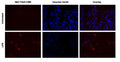 Figure 2. THP-1 cells were treated with PMA (5 ng/mL) followed by LPS (100 ng/mL for 1 hour, lower row of images), or were untreated (upper row of images), and were then immediately stained with 660-YVAD-FMK for 1 hour at 37°C (concurrent with treatment). Cells were then stained with Hoechst 33342 and imaged. Intracellular caspase-1 activity was detected using Cy5 (Ex 620/60, Em 700/75) and DAPI (Ex 375/28, Em 460/50) LED filter cubes at 20X. Data courtesy of Mrs. Tracy Murphy (ICT 230:32).