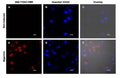 Figure 4. Jurkat cells were treated with a negative control (Panels A-C), or nigericin (10 µM) to induce NLRP3 inflammasome and caspase-1 activation (Panels D-F). Samples were stained with 660-YVAD-FMK, followed by Hoechst 33342 (to label nuclei). Significant caspase-1 activity is seen only after nigericin treatment (D). Panels C & F are overlays of the blue fluorescence, red fluorescence, and DIC channels into a single combined image. Data courtesy of Mrs. Tracy Murphy, ICT (220:98).