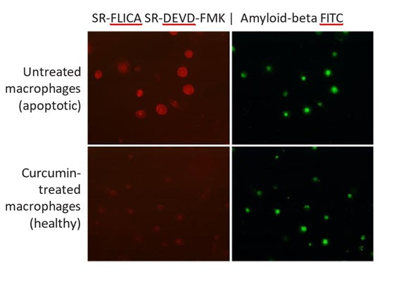 Figure 1. Control Alzheimer's Disease (AD) macrophages and curcumin-treated AD macrophages were exposed to FITC-labeled Aß and stained with SR-DEVD-FMK (