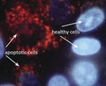 Figure 2. MCF-7 cells were exposed to 0.15 µM camptothecin (Cat. 6210) for 24 hours at 37°C, then stained with MR-(DEVD)2 for 30 minutes at 37°C, washed, and then stained with 1