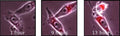 Figure 3. REC:MYC immortalized rat fibroblasts were seeded in a 12-well plate and irradiated (4 Gy, X-ray) the following day. Magic Red ® Fluorescent Caspase-3/7 Substrate, MR-(DEVD)2 (Cat. 935/936), was added, and cells were photographed for 16 hours using an inverted Nikon TE2000 microscope with a CCD camera. The