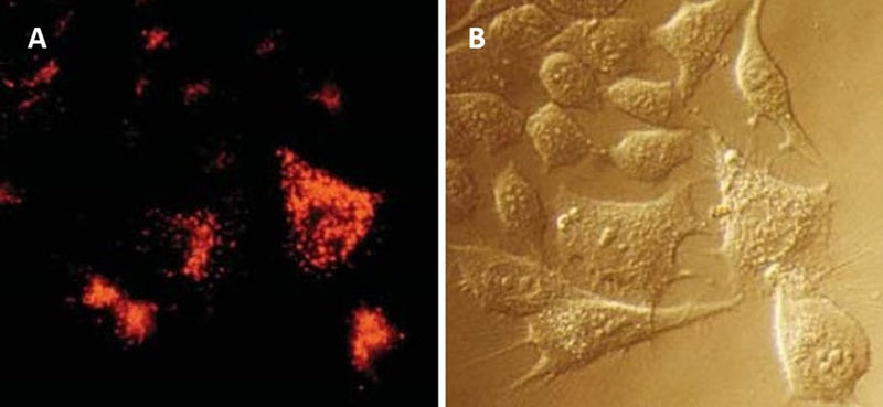 Figure 4. MCF-7 cells were treated with 0.15 µM camptothecin (cat. 6210) for 24 hours at 37°C, then exposed to MR-(DEVD)2 for 60 minutes at 37°C. DEVDase activity is demonstrated by the appearance of orange-red lysosomal bodies (A). The photograph was taken using 541-551 nm excitation with a long pass >640 nm barrier filter (see AO staining in Figure 5). B is the interference contrast image . Data courtesy of Dr. Z. Darzynkiewicz (Brander Cancer Research Center Institute, New York, NY).
