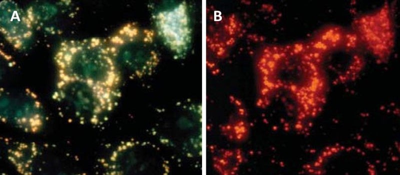 Figure 5. MCF-7 cells were treated with 0.15 µM camptothecin (cat. 6210). Cells were stained with acridine orange in PBS for 30 minutes, then washed. Cells were photographed at 40X using either 492 nm excitation with a 540-550 nm emission filter (A, lysosomes appear yellowish green), or a 540 nm excitation with a long pass >640 nm barrier filter (B, lysosomes appear red). Experiment performed in the laboratory of Dr. Z. Darzynkiewicz (Brander Cancer Research Center Institute, New York, NY).