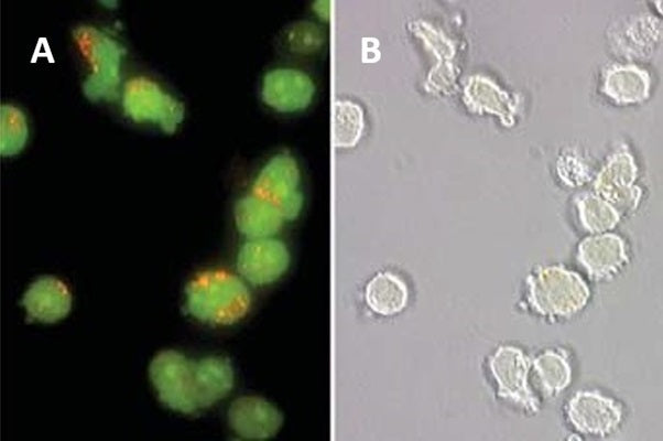 Figure 6. Jurkat cells were stained with acridine orange in PBS for 60 minutes at 37°C. Jurkat cells stained with acridine orange show orange lysosomal staining (A). Photomicrographs were taken using a Nikon Eclipse E800 photomicroscope using a 460-500 nm excitation filter and a 505-560 nm emission / barrier filter set at 300X. Acridine orange-stained lysosomes appear in photo A; photo B shows the corresponding DIC image of the cells (compare with Figure 5).