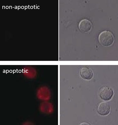 Figure 9. Following the same protocol outlined in Figure 8, Jurkat cells were analyzed to detect DEVDase activity. Negative cells do not fluoresce (top), while apoptotic cells fluoresce red using MR-(DEVD)2 (bottom). Left panels contain the fluorescence image; right panels contain the DIC image (compare with THP-1 cells in Figure 8).