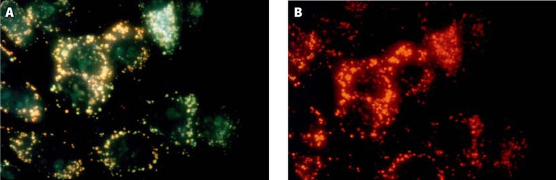 Figure 2. MCF-7 cells were stained with acridine orange for 30 minutes, then washed twice in PBS (cells not stained with Magic Red®) and then analyzed by fluorescence microscopy at 400X using either 492 nm excitation with a 540-550 nm emission filter (A, lysosomes appear yellowish green), or 540 nm excitation with a long pass >640 nm barrier filter (B, lysosomes appear red). Data from the laboratory of Dr. Z. Darzynkiewicz (Brander Cancer Research Center Institute, New York City, NY).