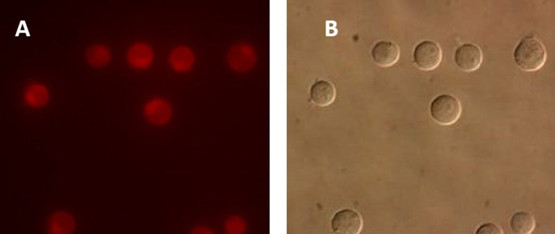 Figure 4. Intracellular cathepsin-B activity detected in Jurkat cells using our MR-(RR)2 cathepsin-B fluorogenic substrate. Intracellular localization of the hydrolyzed fluorescent Magic Red® product was detected using a Nikon Eclipse E800 photomicroscope fitted with 510–560 nm excitation and 570–620 nm emission/barrier filters at 500X (A). The corresponding DIC image is shown in (B). Data courtesy of Dr. Brian Lee, ICT, 061202.