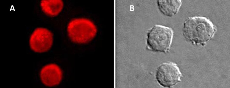 Figure 2. Intracellular cathepsin activity was detected in HL60 cells using Magic Red®-(LR)2 cathepsin K fluorogenic substrate. Intracellular localization of the hydrolyzed fluorescent Magic Red® product was detected using a Nikon Eclipse E800 photomicroscope equipped with a 510–560 nm excitation filter and a 570–620 nm emission/barrier filter at 500X (A). Photo at right (B) shows the corresponding DIC image of the cells. Data courtesy of Dr. Brian Lee, ICT, 061202.