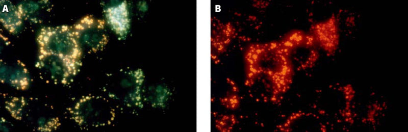 Figure 3. MCF-7 cells were stained with acridine orange for 30 minutes, washed twice in PBS (cells not stained with Magic Red®) and then analyzed by fluorescence microscopy at 400X using either 492 nm excitation with a 540-550 nm emission filter (A, lysosomes appear yellowish green), or 540 nm excitation with a long pass >640 nm barrier filter (B, lysosomes appear red). Data from the laboratory of Dr. Z. Darzynkiewicz (Brander Cancer Research Center Institute, New York City, NY).