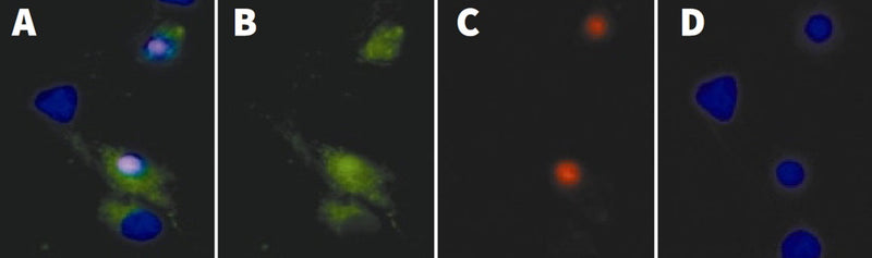 Figure 1. Cell death in primary rat hippocampal neurons. (A) is a composite of FLICA® FAM-DEVD-FMK (B), PI (C), and Hoechst (D). DNA is labeled in 4 cells (D), 3 cells are caspase-positive (B), 2 are membrane-compromised (C). One cell is in early apoptosis (green but not red). Two FLICA®-positive cells are also PI-positive (red, C) (becoming membrane compromised) and are in the late stages of apoptosis rather than necrosis. Data courtesy of Dr. Z. Kahraman Akozer, University of Maryland.