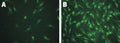 Figure 2. Normal (A) and keratoconus (B) corneal fibroblasts were treated with 200 μM H2O2 for 1 hour, washed, and allowed to recover. Cells were then treated with FAM-DEVD-FMK (Cat. 93/94) for 1 hour, then washed with 1X Apoptosis Wash Buffer. Keratoconus corneal fibroblasts treated with H2O2 (B) show a significant