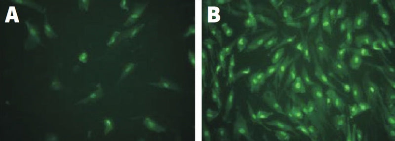 Figure 2. Normal (A) and keratoconus (B) corneal fibroblasts were treated with 200 μM H2O2 for 1 hour, washed, and allowed to recover. Cells were then treated with FAM-DEVD-FMK (cat. 93/94) for 1 hour, then washed with 1X Apoptosis Wash Buffer. Keratoconus corneal fibroblasts treated with H2O2 (B) show a significant increase in caspase-3/7 activity compared to normal cells (A). Non-apoptotic cells are dark in background. Data courtesy of Dr. Cristina Kenney, University of California, Irvine.