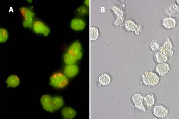 Figure 3. Jurkat cells stained with acridine orange in PBS for 60 minutes at 37°C show orange lysosomal staining (A). Photomicroscope (Nikon Eclipse E800) analysis using a 460-500 nm excitation filter and a 505-560 nm emission/barrier filter set at 300X. Panel B shows the corresponding DIC image. Data courtesy of Dr. Brian Lee, ICT, 061202.