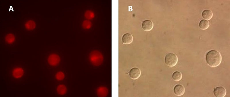 Figure 4. Intracellular cathepsin L activity was detected in Jurkat cells using our MR-(FR)2 cathepsin L fluorogenic substrate. Intracellular localization of the hydrolyzed fluorescent Magic Red® product was detected using a Nikon Eclipse E800 photomicroscope fitted with 510–560 nm excitation and 570–620 nm emission/barrier filters at 400X (A). The corresponding DIC image is shown in (B). Data courtesy of Dr. Brian Lee, ICT, 061202.