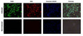 Figure 2. Jurkat cells were exposed to staurosporine to induce apoptosis and increase serine protease activity (upper), or left untreated (lower), then stained with FAM-Phe-CMK (Cat. 945/946), 660-VAD-FMK (Cat. 9120), and Hoechst 33342. Imaged using EGFP (Ex 470/30, Em 530/50), Cy5 (Ex 620/60, Em 700/75), and DAPI (Ex 375/28, Em