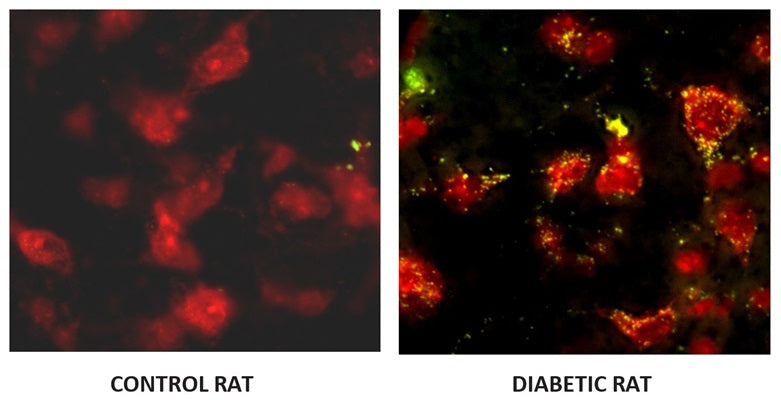 Figure 3. Dr. Thomas Morrow at the University of Michigan VAMC Ann Arbor assessed neurodegeneration in diabetes via caspase activity in control (left) and 8-week STZ diabetic rats (right). FAM in vivo probe (cat. 981) was injected intravenously to label caspase-positive apoptotic neurons. After sacrifice, frozen sections of the PAG were prepared and counter-stained with Nissl to identify all neurons. Apoptotic neurons exhibit dual staining with FAM in vivo probe (yellow/green) and Nissl (red). 