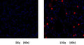 Figure 2. Mice were given either a 0Gy or 15Gy whole lung dose of gamma irradiation. SR in vivo probe (Cat. 982/983) was injected and allowed to circulate for 18 hours prior to sacrifice. Paraffin sections were prepared, nuclei stained with DAPI