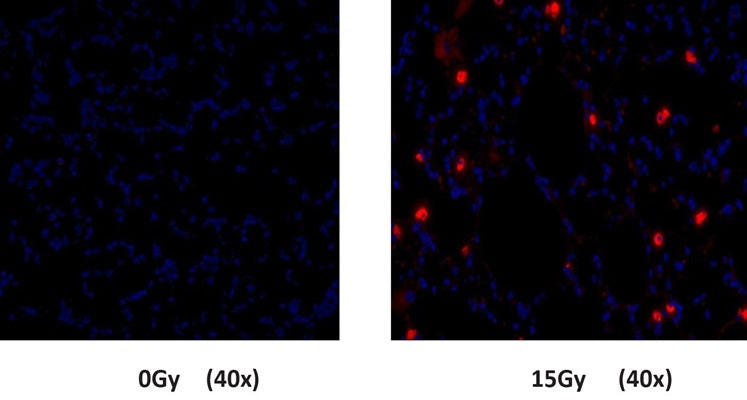 Figure 2. Mice were given either a 0Gy or 15Gy whole lung dose of gamma irradiation. SR in vivo probe (Cat. 982/983) was injected and allowed to circulate for 18 hours prior to sacrifice. Paraffin sections were prepared, nuclei stained with DAPI (blue), and lungs imaged with a fluorescence microscope. Caspase activity (red) was induced in irradiated mice compared to control animals. Data courtesy of E. Hernady (University of Rochester Medical Center, Rochester, NY).