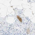 Immunohistochemistry detection of Pro/Actived Complement C1s in human rectum tissue using Anti-Pro/Actived Complement C1s Antibody (Cat. ABS 002-09-010). Tissue was mounted and pariffin fixed. Heat induced antigen retrieval was performed using citrate buffer, heated, and then blocked. After washing, the primary antibody (Cat. ABS 002-09-010) was incubated with the sample. Staining in the plasma shows distinct positivity.