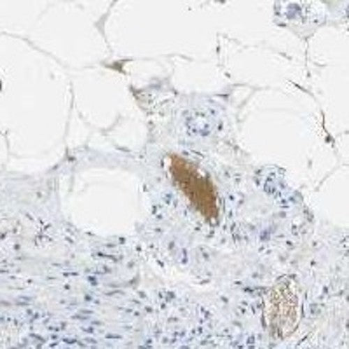 Immunohistochemistry detection of Pro/Actived Complement C1s in human rectum tissue using Anti-Pro/Actived Complement C1s Antibody (Cat. ABS 002-09-010). Tissue was mounted and pariffin fixed. Heat induced antigen retrieval was performed using citrate buffer, heated, and then blocked. After washing, the primary antibody (Cat. ABS 002-09-010) was incubated with the sample. Staining in the plasma shows distinct positivity.
