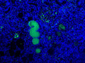 Immunofluorescent staining of Pro/Actived Complement C1s in veins of human kidney with nephritis using Anti-Pro/Actived Complement C1s Antibody (Cat. ABS 002-49-010). Cells where fixed with formaldehyde and permeabilized prior to staining Primary antibody (ABS 002-49-010) was incubated with the cells at a dilution of 1:10.