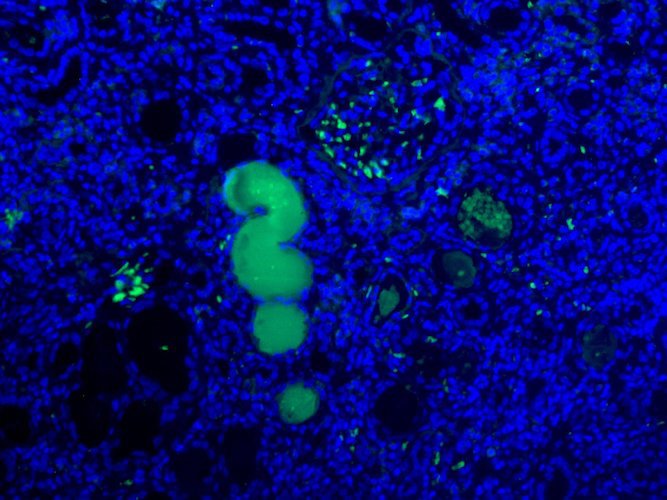Immunofluorescent staining of Pro/Actived Complement C1s in veins of human kidney with nephritis using Anti-Pro/Actived Complement C1s Antibody (Cat. ABS 002-49-010). Cells where fixed with formaldehyde and permeabilized prior to staining Primary antibody (ABS 002-49-010) was incubated with the cells at a dilution of 1:10.