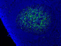 Immunofluorescent staining of Complement C9 in Follicular dendritic cell network in germinal centers of human tonsil tissue using Anti-Complement C9 Antibody (Cat. ABS 004-22-010). Cells where fixed with formaldehyde and permeabilized prior to staining Primary antibody (ABS 004-22-010) was incubated with the cells at a dilution of 1:75.