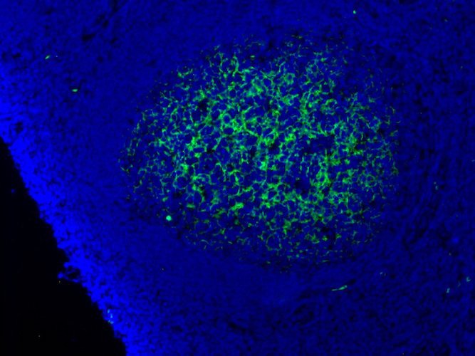 Immunofluorescent staining of Complement C9 in Follicular dendritic cell network in germinal centers of human tonsil tissue using Anti-Complement C9 Antibody (Cat. ABS 004-22-010). Cells where fixed with formaldehyde and permeabilized prior to staining Primary antibody (ABS 004-22-010) was incubated with the cells at a dilution of 1:75.