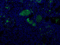 Immunofluorescent staining of Complement C9 in human kidney plasma of veins using Anti-Complement C9 Antibody (Cat. ABS 004-22-010). Cells where fixed with formaldehyde and permeabilized prior to staining Primary antibody (ABS 004-22-010) was incubated with the cells at a dilution of 1:75.