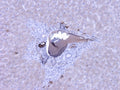 Immunohistochemistry detection of Complement C9 in human liver tissue using Anti-Complement C9 Antibody (Cat. ABS 004-22-010). Tissue was mounted and pariffin fixed. Heat induced antigen retrieval was performed using citrate buffer, heated, and then blocked. After washing, the primary antibody (Cat. ABS 004-22-010) was incubated with the sample at a dilution of 1:100. Plasma of portal veins are strongly stained.