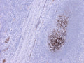 Immunohistochemistry detection of Complement C9 in human tonsil tissue using Anti-Complement C9 Antibody (Cat. ABS 004-22-010). Tissue was mounted and pariffin fixed. Heat induced antigen retrieval was performed using citrate buffer, heated, and then blocked. After washing, the primary antibody (Cat. ABS 004-22-010) was incubated with the sample at a dilution of 1:100. Follicular dendritic cell network stained strongly in germinal centers of tonsil tissue.