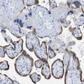 Anti-Pregnancy Associated Plasma Protein A (PAPP-A) Antibody