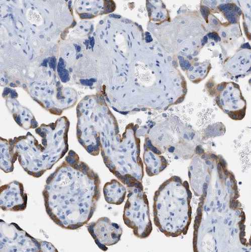 Anti-Pregnancy Associated Plasma Protein A (PAPP-A) Antibody