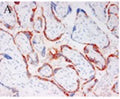 Anti-Pregnancy Associated Plasma Protein A (PAPP-A) Antibody