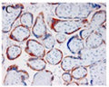 Immunohistochemistry detection of Pregnancy associated plasma protein A (PAPP-A) in human placental tissue using Anti-Pregnancy Associated Plasma Protein A (PAPP-A) Antibody (Cat. ABS 006-24-010). Tissue was mounted and pariffin fixed. Heat induced antigen retrieval was performed using citrate buffer, heated, and then blocked. After washing, the primary antibody (Cat. ABS 006-24-010) was incubated with the sample.