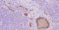 Immunohistochemistry detection of TAT (Thrombin-antithrombin) in human tonsil tissue using Anti-TAT (Thrombin-antithrombin) Antibody (Cat. ABS 014-22-010). Tissue was mounted and pariffin fixed. Heat induced antigen retrieval was performed using citrate buffer, heated, and then blocked. After washing, the primary antibody (Cat. ABS 014-22-010) was incubated with the sample at a dilution of 1:30. Moderate staining intensity of the plasma of the veins.