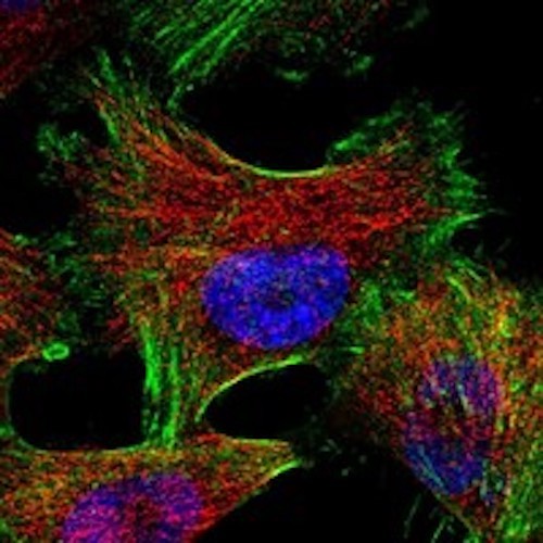 Immunofluorescent staining of Gelsolin in human cell line U-251 MG using Anti-Gelsolin Antibody (Cat. ABS 017-20-010). Cells where fixed with formaldehyde and permeabilized prior to staining Primary antibody (ABS 017-20-010) was incubated with the cells at a dilution of 1:2000.