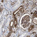 Immunohistochemistry detection of Gelsolin in human kidney tissue using Anti-Gelsolin Antibody (Cat. ABS 017-20-010). Tissue was mounted and pariffin fixed. Heat induced antigen retrieval was performed using citrate buffer, heated, and then blocked. After washing, the primary antibody (Cat. ABS 017-20-010) was incubated with the sample at a dilution of 1:6000.. Staining shows cytoplasmic and membranous positivity in both renal tubules and glomeruli.