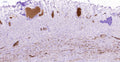 Immunohistochemistry detection of Peptide Histidine Methionine in human appendix tissue using Anti-Peptide Histidine Methionine Antibody (Cat. ABS 020-03-010). Tissue was mounted and pariffin fixed. Heat induced antigen retrieval was performed using citrate buffer, heated, and then blocked. After washing, the primary antibody (Cat. ABS 020-03-010) was incubated with the sample at a dilution of 1:200. Plasma of the veins stained strongly as well as ganglion cells of neuronal plexuses and neuronal axons.