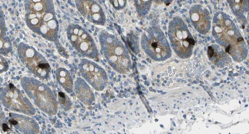 Immunohistochemistry detection of Gastric Inhibitory Polypeptide in human duodenum tissue using Anti-Gastric Inhibitory Polypeptide Antibody (Cat. ABS 021-04-010). Tissue was mounted and pariffin fixed. Heat induced antigen retrieval was performed using citrate buffer, heated, and then blocked. After washing, the primary antibody (Cat. ABS 021-04-010) was incubated with the sample.