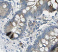 Immunohistochemistry detection of Gastric Inhibitory Polypeptide in human small intestine tissue using Anti-Gastric Inhibitory Polypeptide Antibody (Cat. ABS 021-04-010). Tissue was mounted and pariffin fixed. Heat induced antigen retrieval was performed using citrate buffer, heated, and then blocked. After washing, the primary antibody (Cat. ABS 021-04-010) was incubated with the sample.