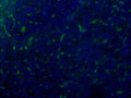 Immunofluorescent staining of Vasoactive Intestinal Peptide in nerves of exocrine part of human pancreas using Anti-Vasoactive Intestinal Peptide Antibody (Cat. ABS 023-02-010). Cells where fixed with formaldehyde and permeabilized prior to staining Primary antibody (ABS 023-02-010) was incubated with the cells at a dilution of 1:100.