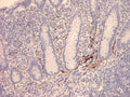 Immunohistochemistry detection of Vasoactive Intestinal Peptide in human appendix tissue using Anti-Vasoactive Intestinal Peptide Antibody (Cat. ABS 023-02-010). Tissue was mounted and pariffin fixed. Heat induced antigen retrieval was performed using citrate buffer, heated, and then blocked. After washing, the primary antibody (Cat. ABS 023-02-010) was incubated with the sample at a dilution of 1:100.