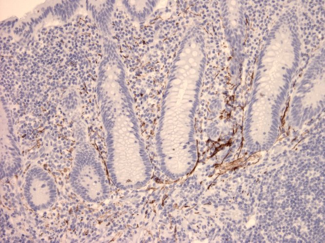Immunohistochemistry detection of Vasoactive Intestinal Peptide in human appendix tissue using Anti-Vasoactive Intestinal Peptide Antibody (Cat. ABS 023-02-010). Tissue was mounted and pariffin fixed. Heat induced antigen retrieval was performed using citrate buffer, heated, and then blocked. After washing, the primary antibody (Cat. ABS 023-02-010) was incubated with the sample at a dilution of 1:100.
