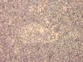 Immunohistochemistry detection of Vasoactive Intestinal Peptide in human appendix tissue using Anti-Vasoactive Intestinal Peptide Antibody (Cat. ABS 023-02-010). Tissue was mounted and pariffin fixed. Heat induced antigen retrieval was performed using citrate buffer, heated, and then blocked. After washing, the primary antibody (Cat. ABS 023-02-010) was incubated with the sample at a dilution of 1:100.